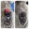 Freezpen – ultrafine cryosurgery